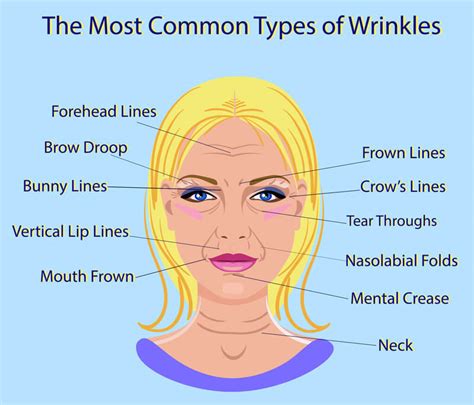 types  wrinkles  face  xxx hot girl