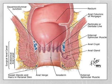 anal and perianal disease part 1