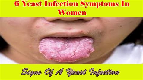 6 Yeast Infection Symptoms In Women Signs Of A Yeast