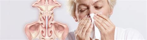 chronic rhinitis and post nasal drip symptoms treatment center by