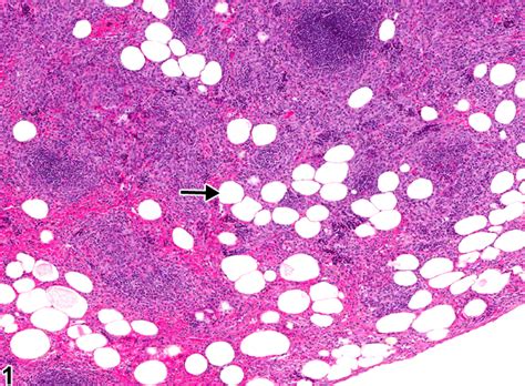 spleen adipocyte metaplasia nonneoplastic lesion atlas