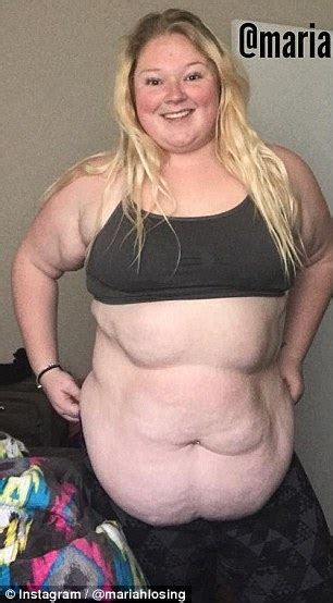 Teen Who Weighed 300lbs Details Gastric Bypass Surgery