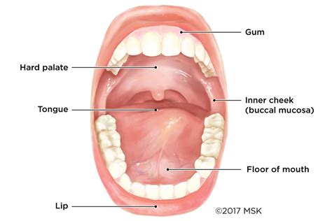 what does the first stages of mouth cancer look like self oral cancer