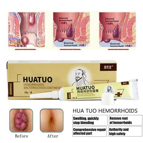 hemorrhoids ointment chinese cream powerful hemorrhoids cream internal