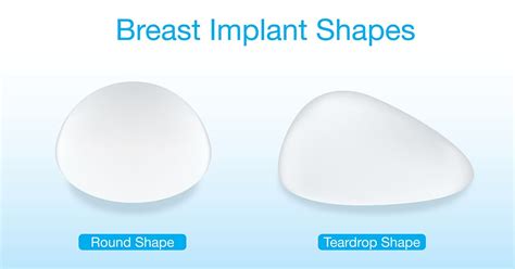 the ultimate guide to textured breast implants for lymphoma bia alcl