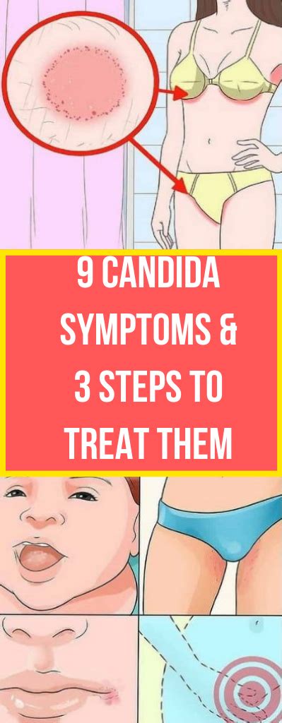 Let Start Slim Today 9 Candida Symptoms And 3 Steps To