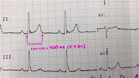 qt interval youtube