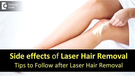 side effects  laser hair removalcare  laser hair removal dr divya sharmadoctors