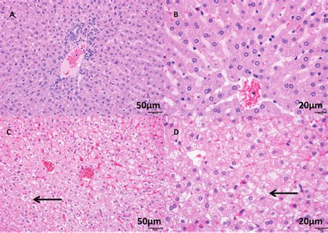 staining  liver tissue  normal hepatocytes   arranged  scientific