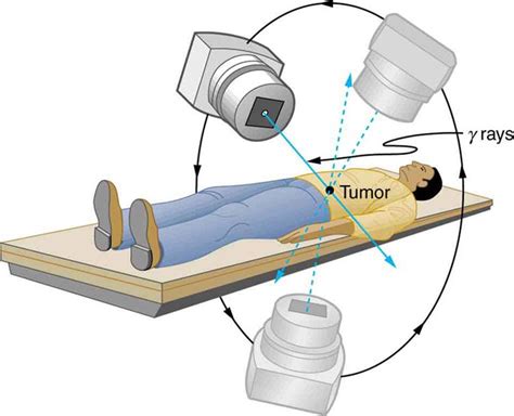 gamma radiation     radiotherapy  treat tumours  cancer aqa p pinterest