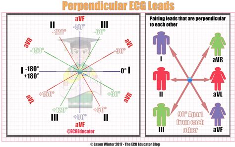 ecg educator blog cardiac axis  easy