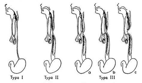 Paper Normal Development Of The Trachea And Esophagus In Man Embryology