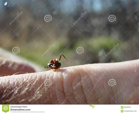 Ant Biting Finger Royalty Free Stock Image 85546072