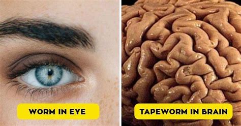 11 of the most disturbing things found inside a human s body