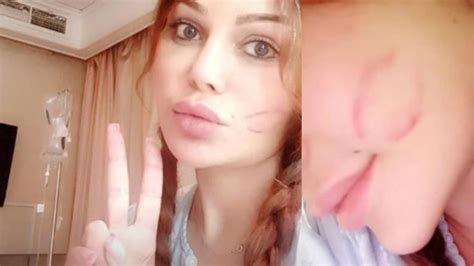 Haifa Wehbe Celebrates Being Healthy Again With Kisses Al Bawaba