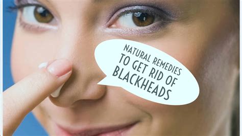 natural remedies   rid  blackheads