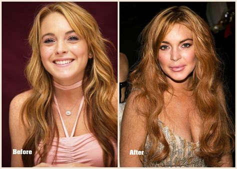 top 10 worst celebrity plastic surgery disasters from