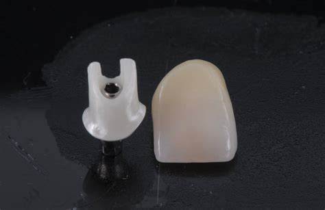 implant abutments art dental lab