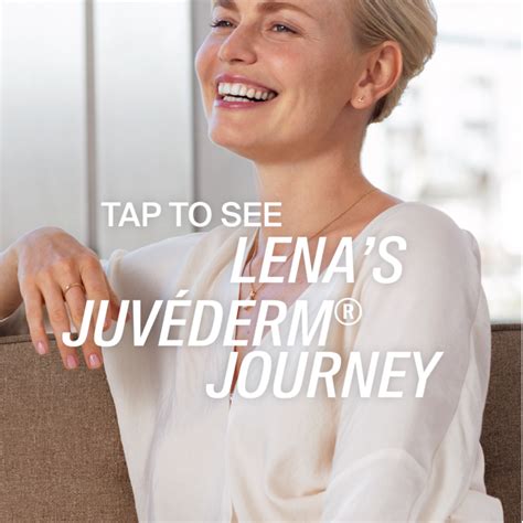 JuvÉderm® Journey — Before And After Instagram Story Lena – Allergan