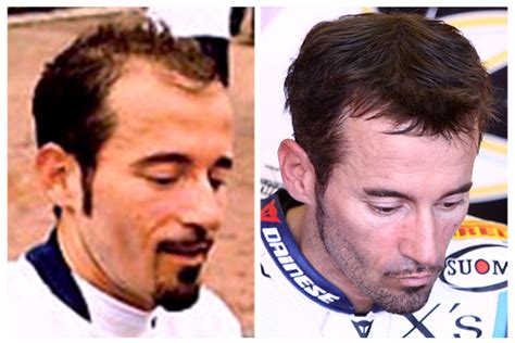 In occasione di un'intervista de “le iene” riguardo l'intervento di autotrapianto di capelli, conta ha specificato che “il look, soprattutto per un calciatore, . Ecco tutti gli sportivi con il parrucchino! FOTO