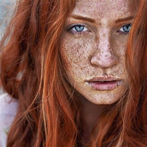 Pin On Redheads Freckles