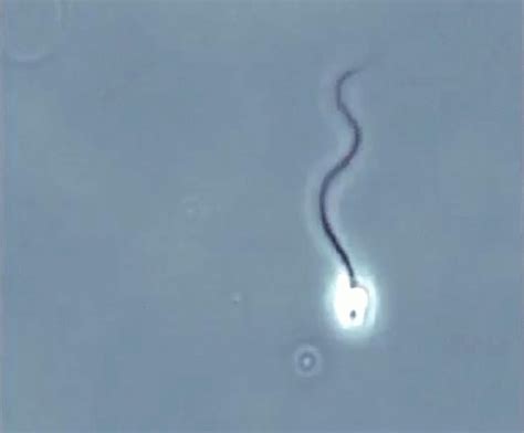sperm spiralling to the egg health and disease medium