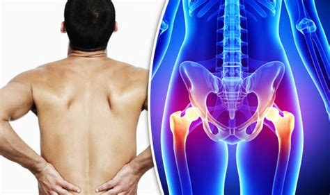 What Is Causing The Pain In My Hip And Back Dr Rosemary Answers Your
