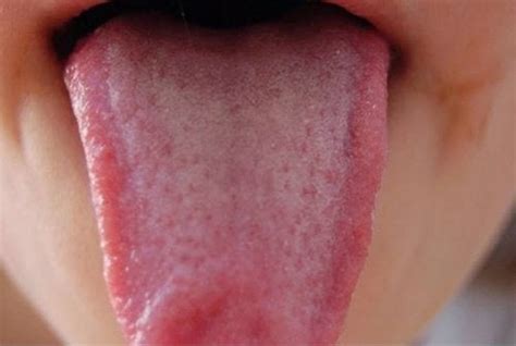 9 Things Your Tongue Is Trying To Tell You About Your Health