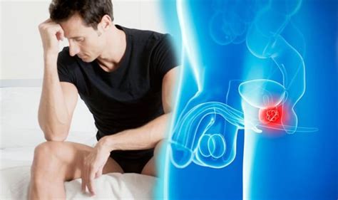 Prostate Cancer The Sexual Ailment That You Should Not Ignore