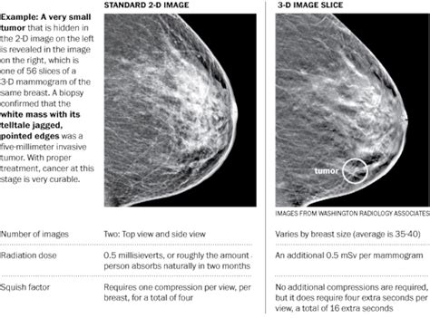 another way to look at breasts the washington post
