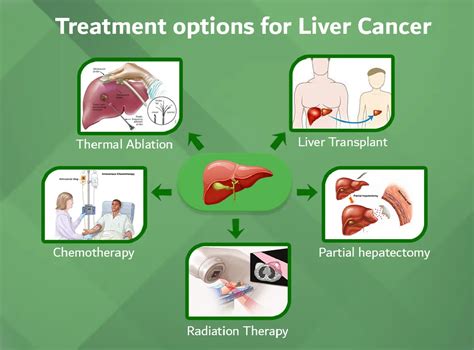 liver cancer treatments surgery chemotherapy radiation
