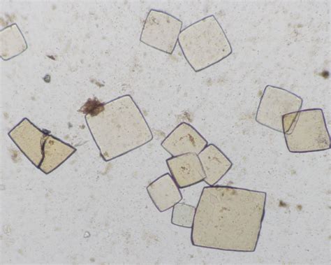 urine crystals eclinpath