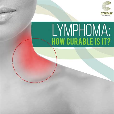 lymphoma curable lymphatic cancer cytecare