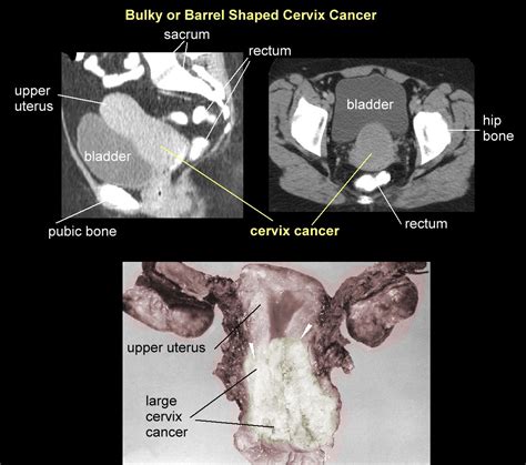 uterus ct scan labeled ct scan machine images and photos finder