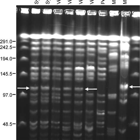 A S1 Nuclease Digestion Pulsed Field Gel Electrophoresis Pfge Of