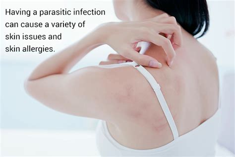 10 Symptoms Of Parasitic Infection Emedihealth