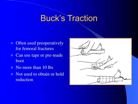 bucks traction pic napkin