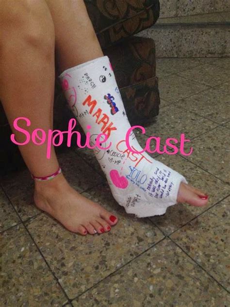 sophie cast slc s casts and feet