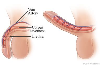 Penile vacuum pump sex positions