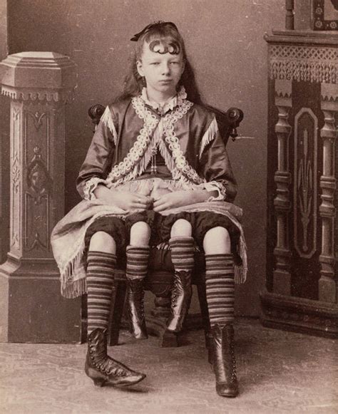 25 Tragic Photos From Freak Shows Of Decades Past