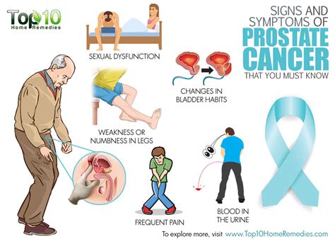 Prostate Cancer Symptoms Current Health Advice Health Blog