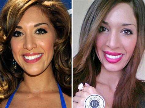 farrah abraham lip injections plastic surgery before and