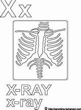 Coloring Ray Pages Alphabet Letter Xray Sheet Template Letters Templates sketch template