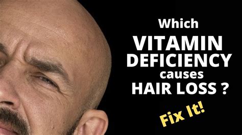 vitamin deficiency  hair loss learn   rid