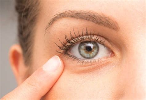 Awake And Refreshed 5 Ways To Revive Tired Looking Eyes By