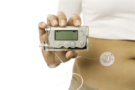 Insulin Pump The Johns Hopkins Patient Guide To Diabetes