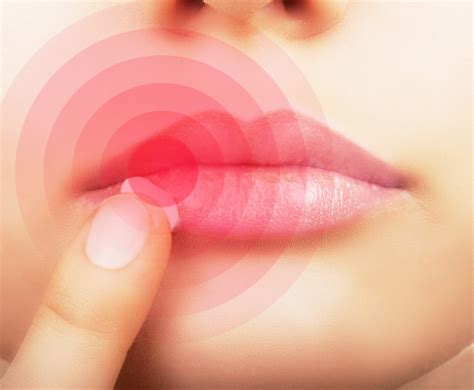唇にできる血豆の正体！「血腫」の原因と対処法