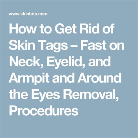 best 25 skin tag on eyelid ideas on pinterest skin tags home remedies removal of skin tags