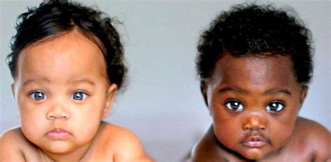 Mom Shares Photos Of Twins With Different Skin Tones