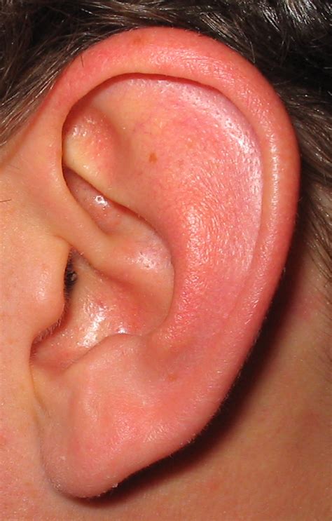 big chunk  ear wax randomly falls    ear